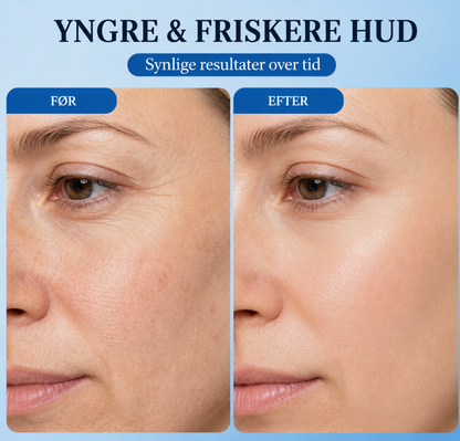 SORENNE HydraLift Serum